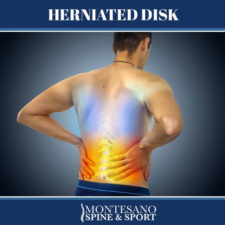Read more about the article Herniated Disk