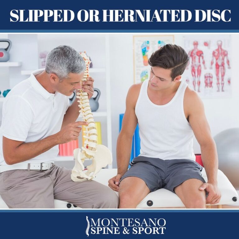 Read more about the article Do you have a slipped disc or herniated disk?