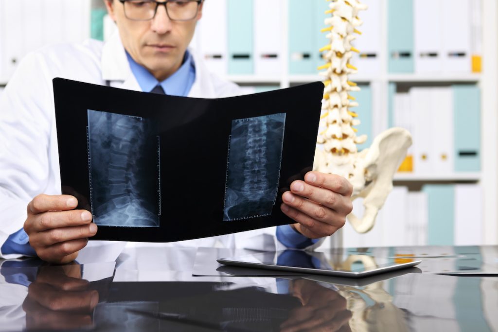 Interesting Facts About Spine Surgery