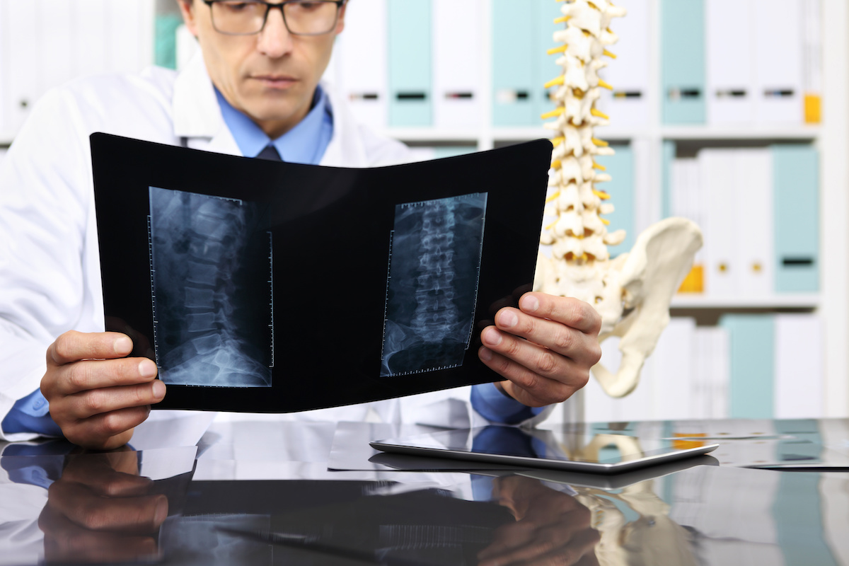 Read more about the article Interesting Facts About Spine Surgery