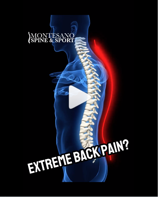 Read more about the article Disc Replacement Surgery to be Pain Free