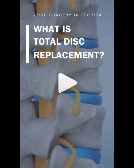 Read more about the article What is Total Disc Replacement (TDR)?