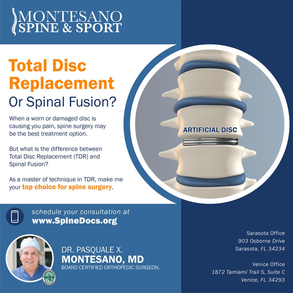 When a worn or damaged disc is causing you pain, Total Disc Replacement (TDR) or Spinal Fusion may be the best treatment.