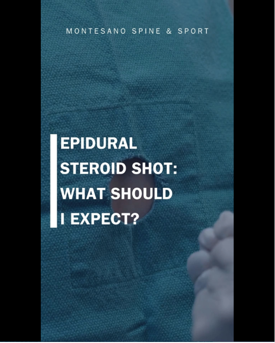 Read more about the article What is an Epidural Steroid Shot?