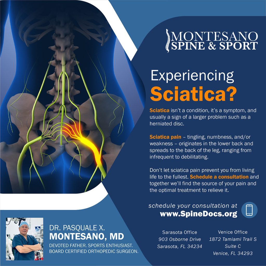 Sciatica pain – tingling, numbness, or weakness – originates in the lower back and spreads to the back of the leg. 