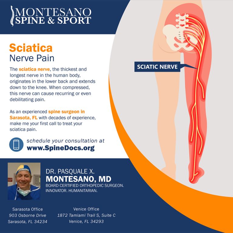 Read more about the article Sciatica Nerve Pain