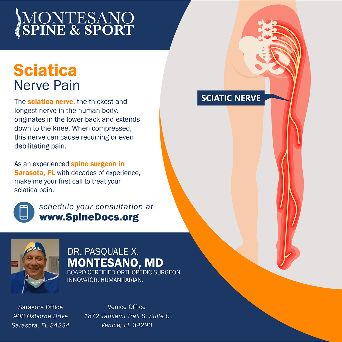 Sciatica Pain - Dr. Pasquale X. Montesano | Sarasota, FL