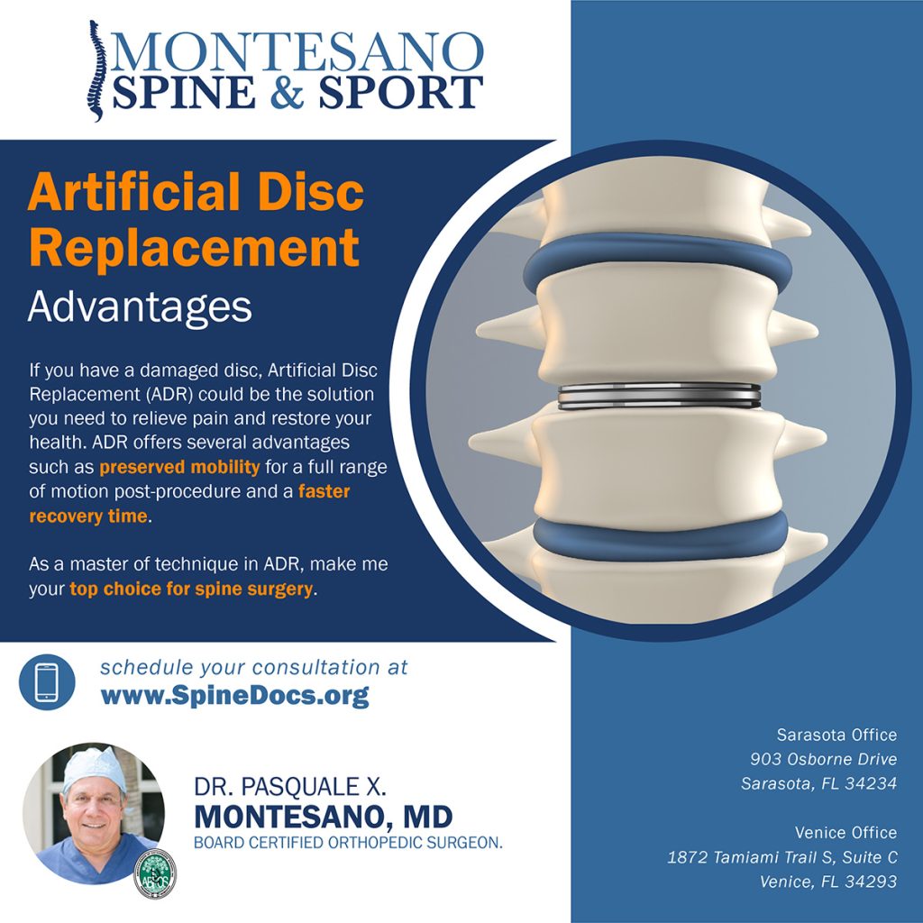 If you have a damaged disc, Artificial Disc Replacement (ADR) could be the solution you need to relieve pain and restore your health. 