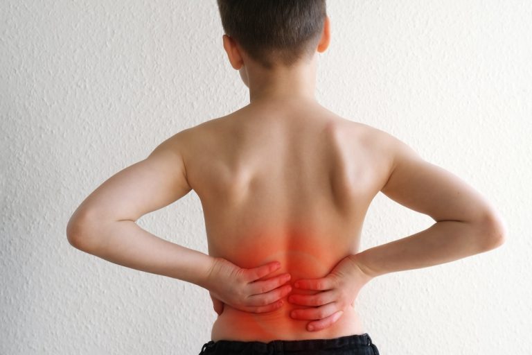 Read more about the article Spinal Stenosis In Children