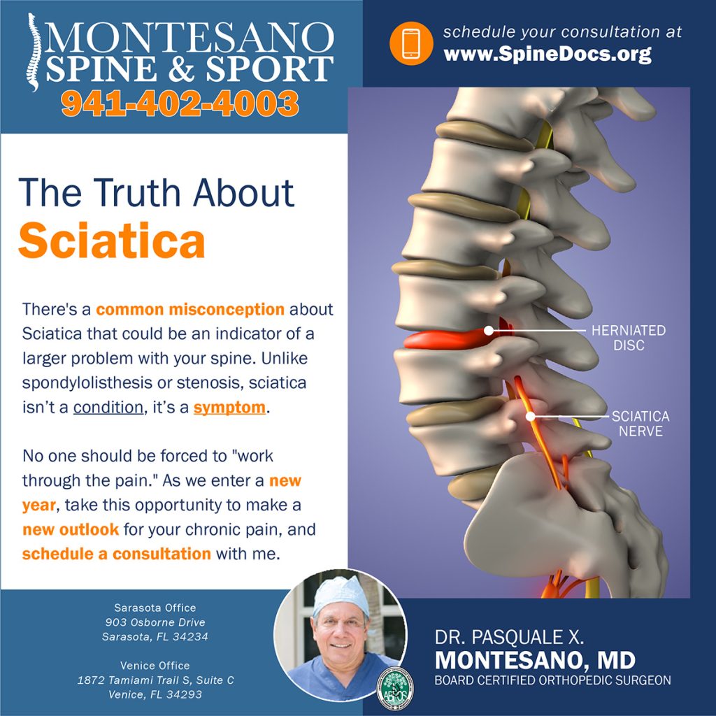 There's a common misconception about Sciatica that could be an indicator of a larger problem with your spine.