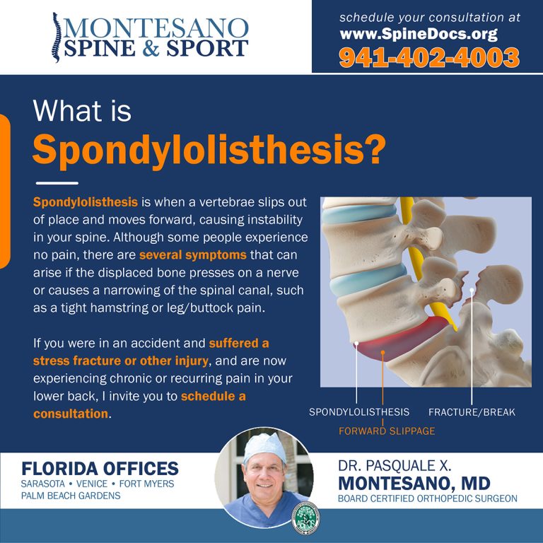 Read more about the article What is Spondylolisthesis?