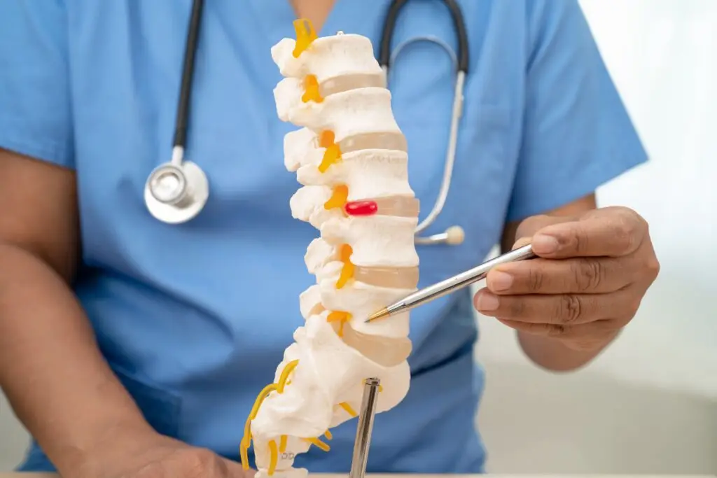 Seizure Risks: Disc Replacement vs Spinal Fusion