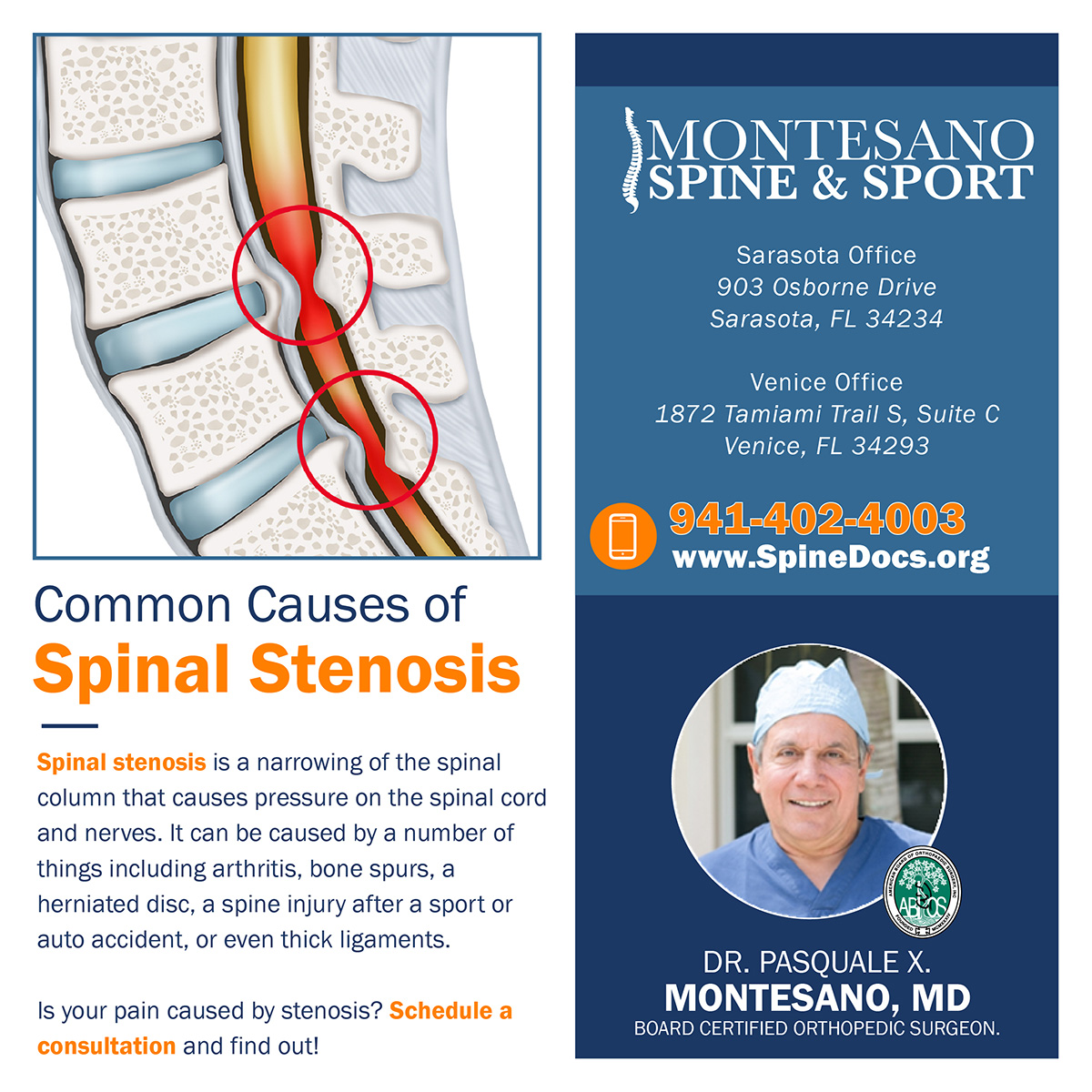 Read more about the article Common Causes of Spinal Stenosis