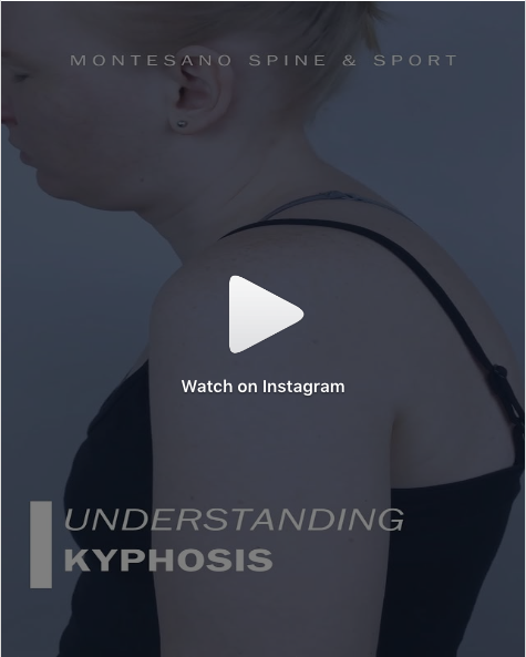 Read more about the article What is Kyphosis?