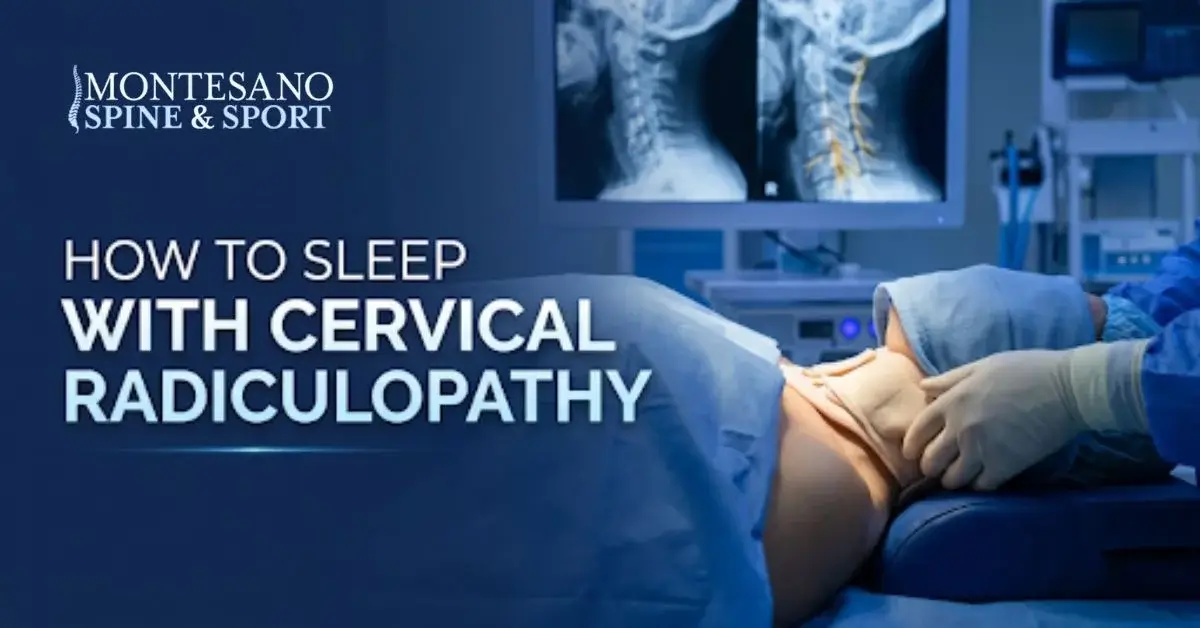 how to sleep with cervical radiculopathy